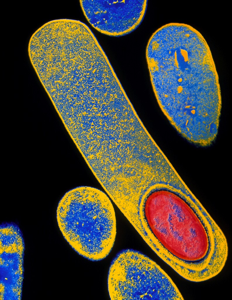 Uni-Gold™ C. difficile GDH Control Kit - Trinity Biotech plc is a ...